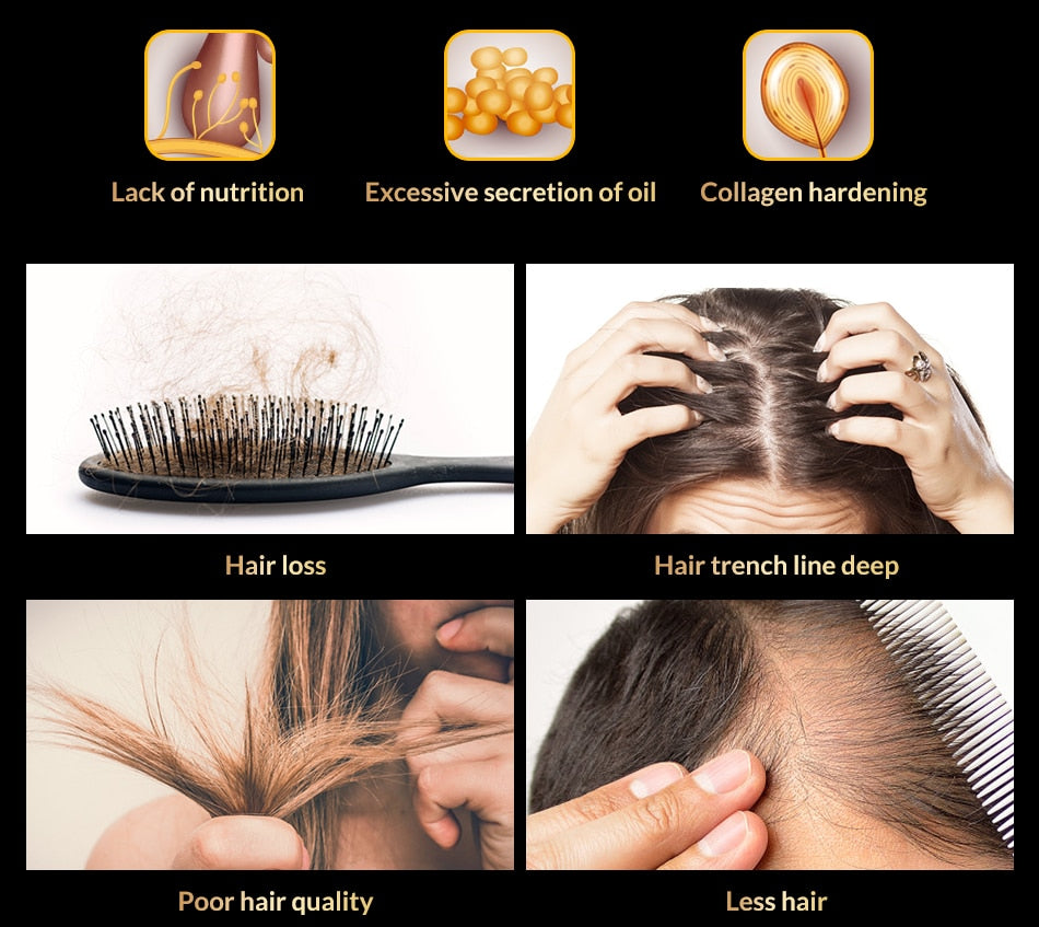 Anti Hair Loss Spray - Glow Dusk