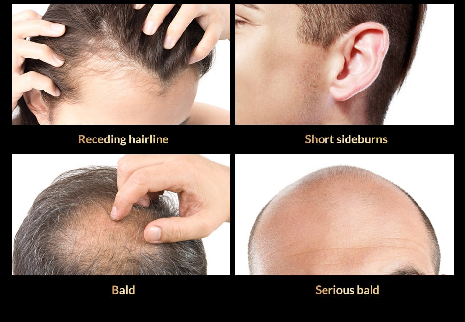Anti Hair Loss Spray - Glow Dusk