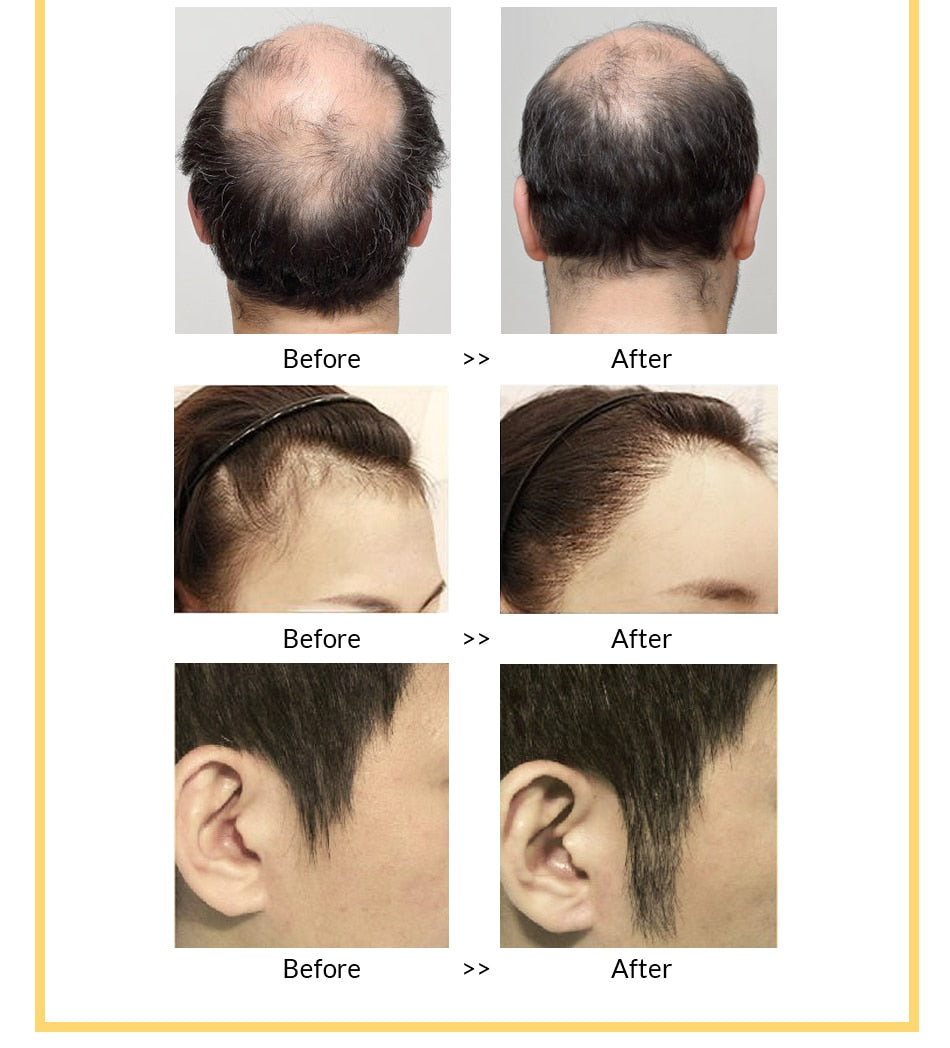 Anti Hair Loss Spray - Glow Dusk